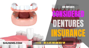 Implants: Dental Insurance or Not?