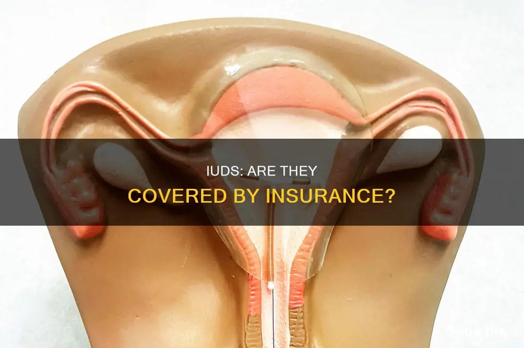 are iuds free with insurance
