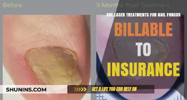 Laser Nail Fungus Treatment: Insurance Coverage?