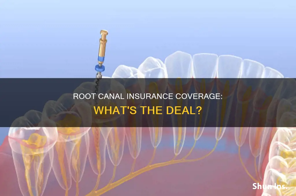 are root canals covereage by insurance