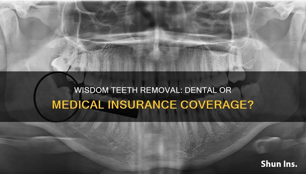 are wisdom teeth removal billed under dental or medical insurance