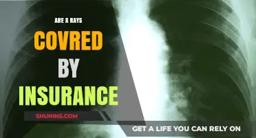 X-Ray Insurance Coverage: What's the Deal?