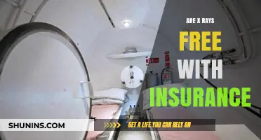 X-Ray Costs: Are You Covered by Insurance?