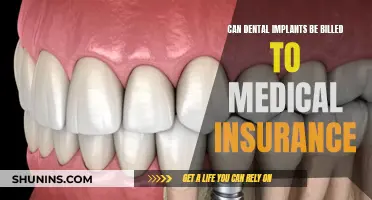 Dental Implants: Medical Insurance Billing Options Explored