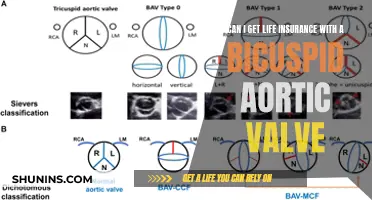 Life Insurance Options with Bicuspid Aortic Valve