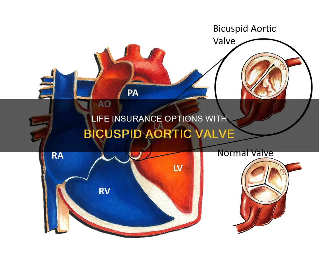 can I get life insurance with a bicuspid aortic valve