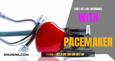 Life Insurance with a Pacemaker: Is It Possible?