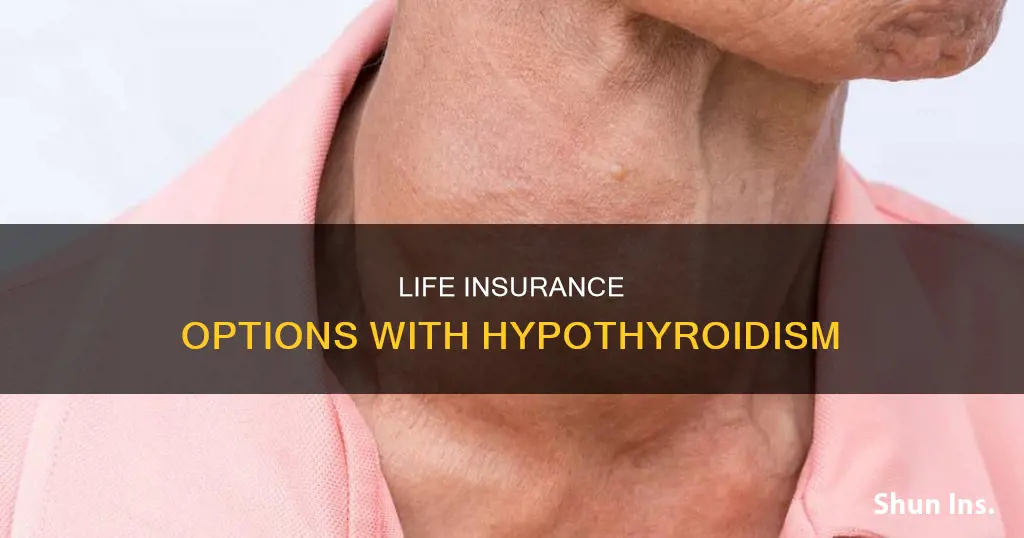 can I still get life insurance if I have hypothyroidism