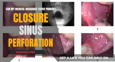 Medical Insurance Coverage for Primary Sinus Perforation Closure