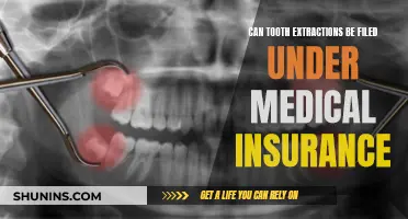 Tooth Extraction: Medical Insurance Coverage Explained