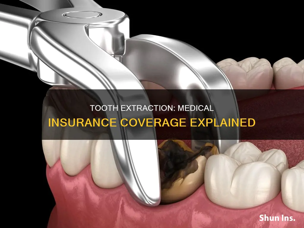 can tooth extractions be filed under medical insurance