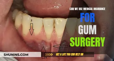 Gum Surgery and Medical Insurance: What's Covered?