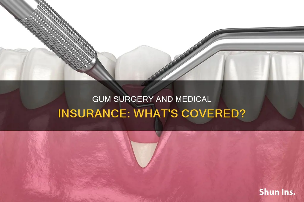 can we use medical insurance for gum surgery