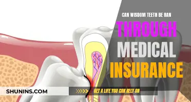 Wisdom Teeth Removal: Insurance Coverage and Costs