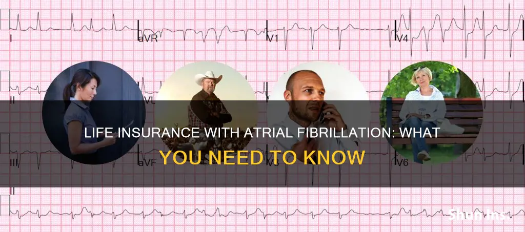 can you get life insurance if you have afib