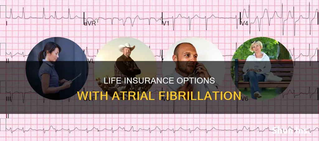 can you get life insurance if you have atrial fibrillation