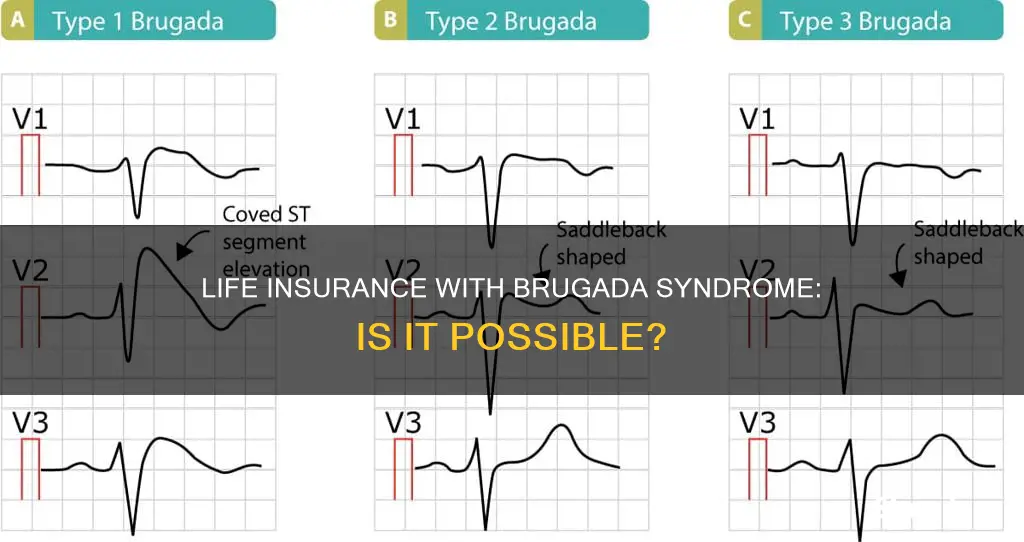 can you get life insurance if you have brugada syndrome