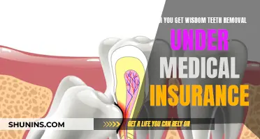 Wisdom Teeth Removal: Insurance Coverage and Costs