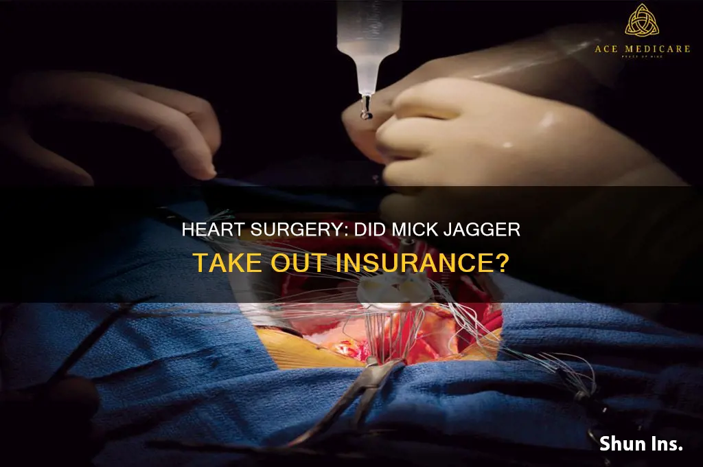 did mick jagger have insurance for his heart surgery