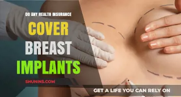 Does Health Insurance Cover Breast Implants? What You Need to Know