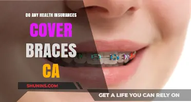 Does California Health Insurance Cover Braces? What You Need to Know