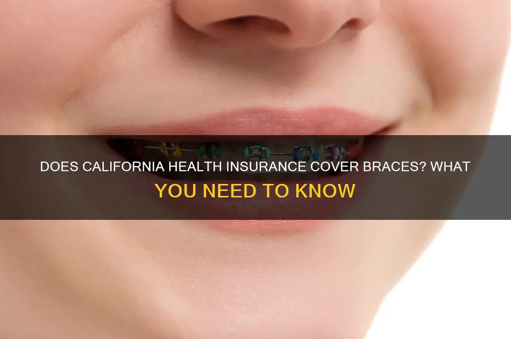 do any health insurances cover braces ca