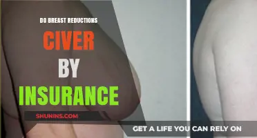Does Insurance Cover Breast Reduction? What You Need to Know