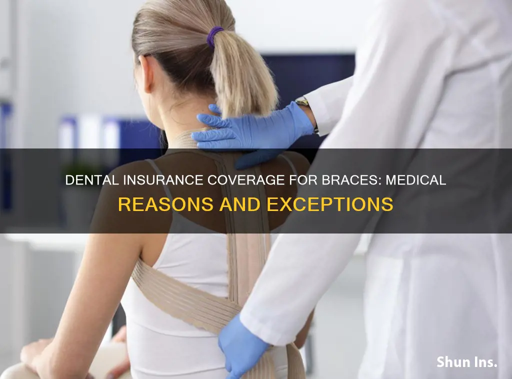 do dental insurance companies cover braces for medical reasons