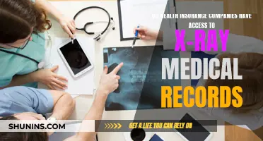 Health Insurance Companies and X-Ray Record Access Explained