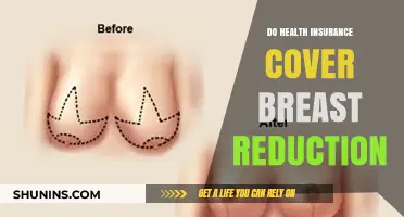 Does Health Insurance Cover Breast Reduction? What You Need to Know