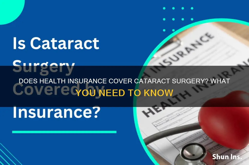 do health insurance cover cataract surgery