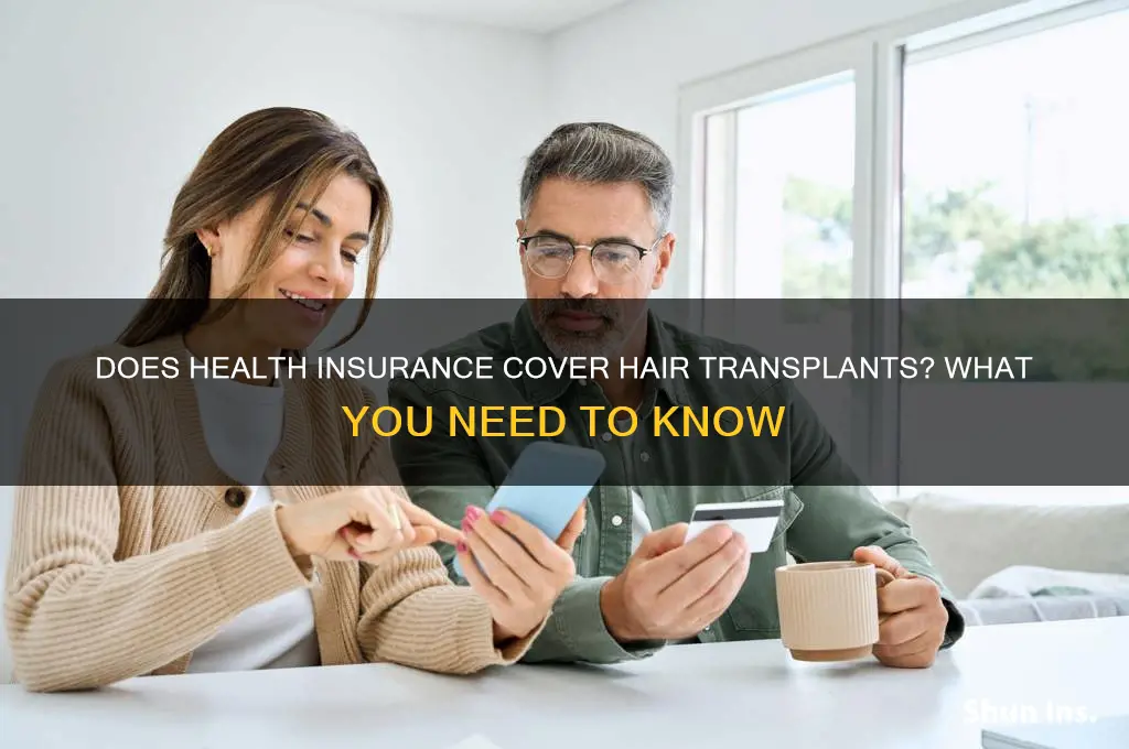 do health insurance cover hair transplant