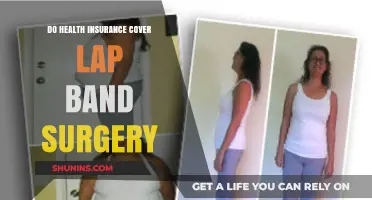 Does Health Insurance Cover Lap Band Surgery? What You Need to Know
