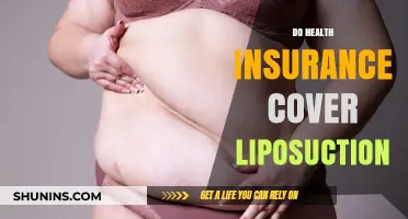 Does Health Insurance Cover Liposuction? What You Need to Know