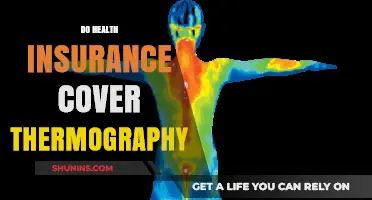 Does Health Insurance Cover Thermography? What You Need to Know