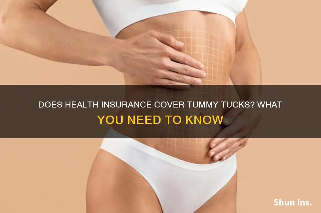 do health insurance cover tummy tuck