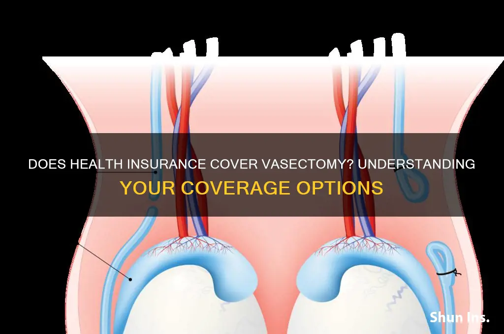 do health insurance cover vasectomy