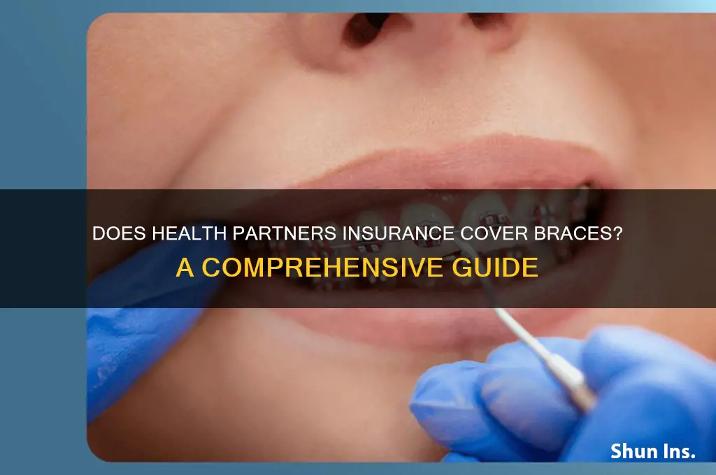 do health partners insurance cover braces