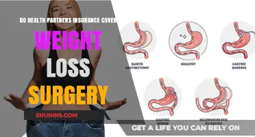 Does Health Partners Insurance Cover Weight Loss Surgery?