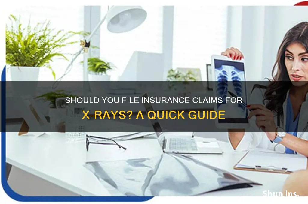 do i have to file with insurance for xrays