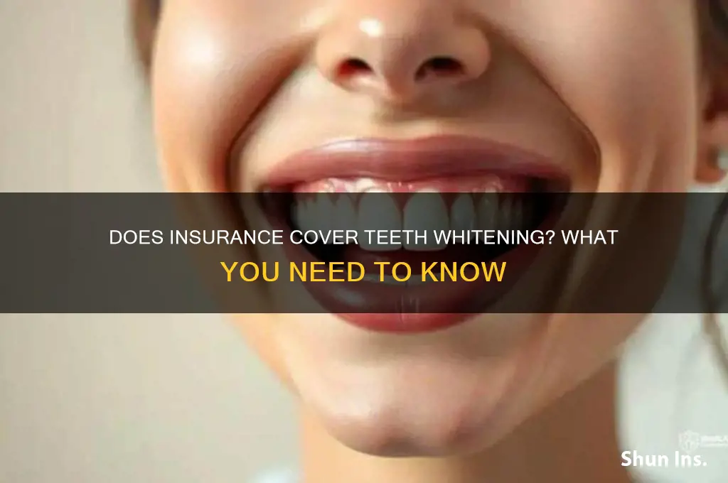 do insurance pick up teeth whitening