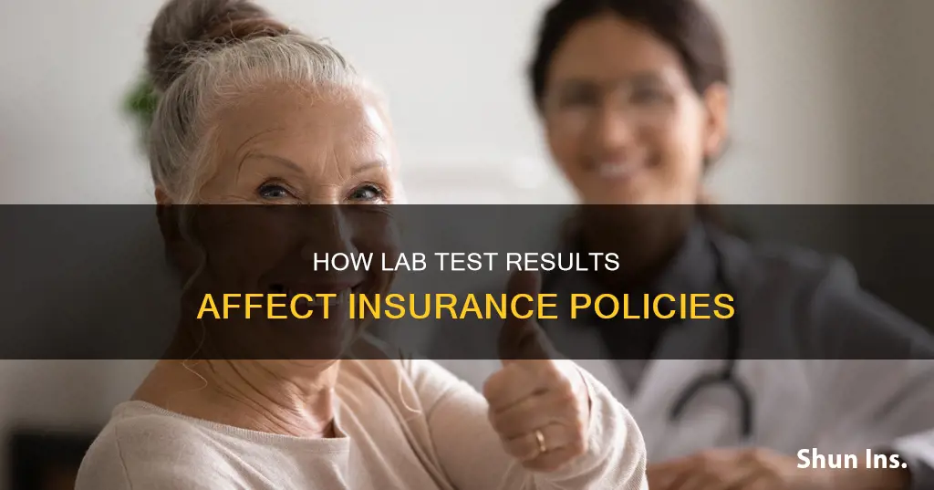 do lab test results go to the insurance provider
