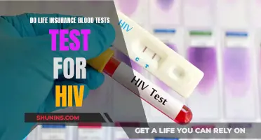 Life Insurance Blood Tests: HIV Testing Included?