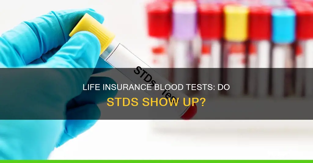 do life insurance blood tests test for stds