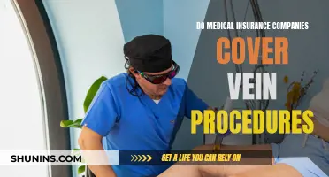 Vein Procedure Coverage: What Your Medical Insurance Offers