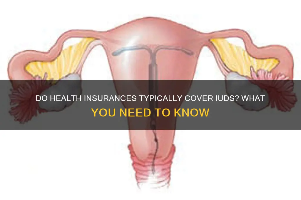 do most health insurances cover iuds