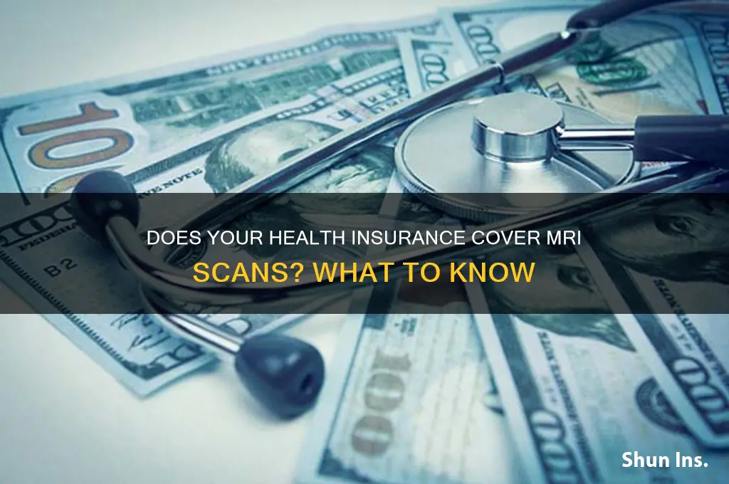do most health insurances cover mri