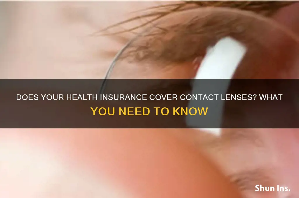 do my health insurance cover contact lenses