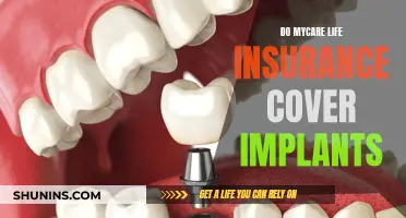 Implant Coverage: MyCare Life Insurance and Your Options