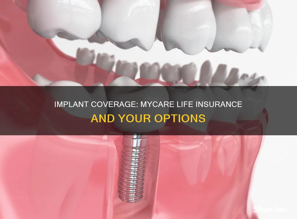 do mycare life insurance cover implants